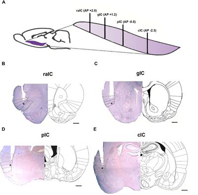 The Role of the Rodent Insula in Anxiety